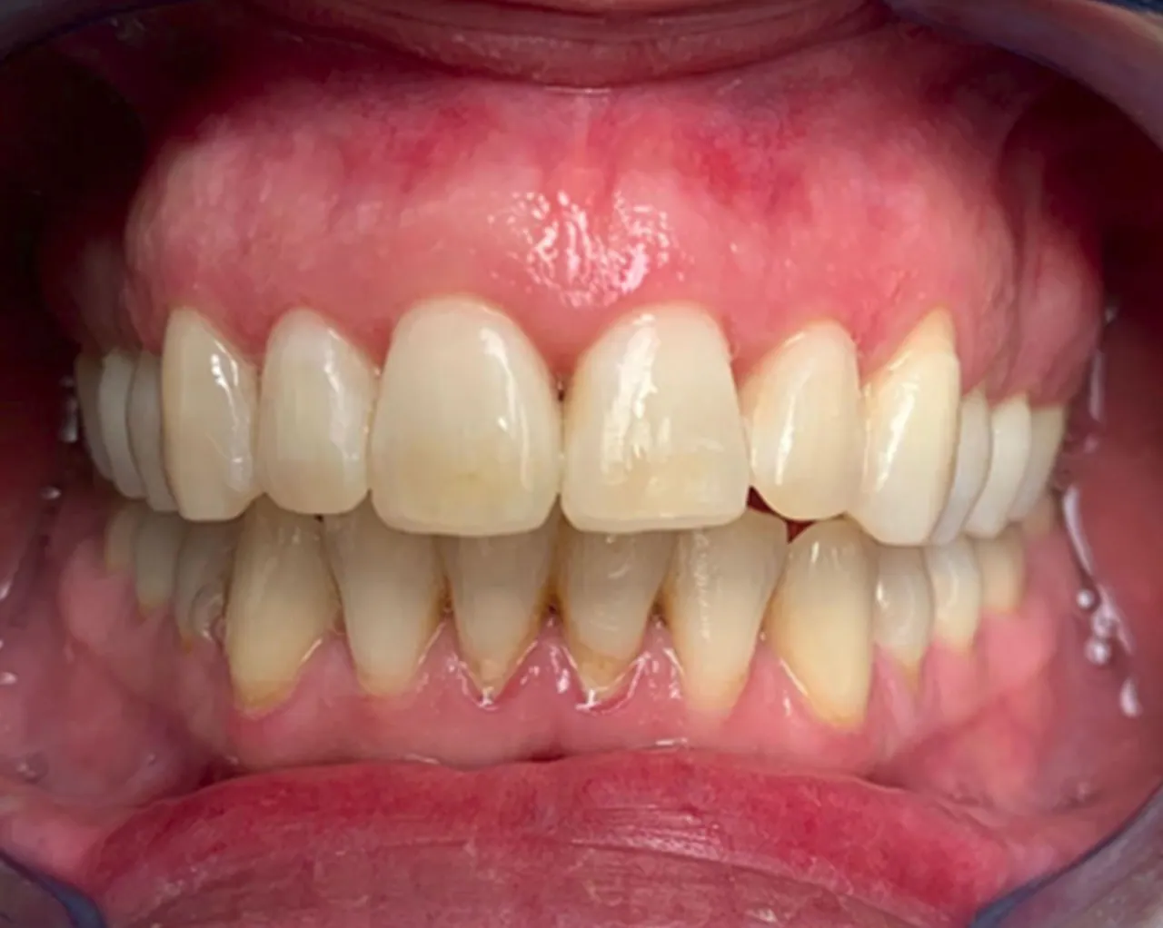 Case 01 — After