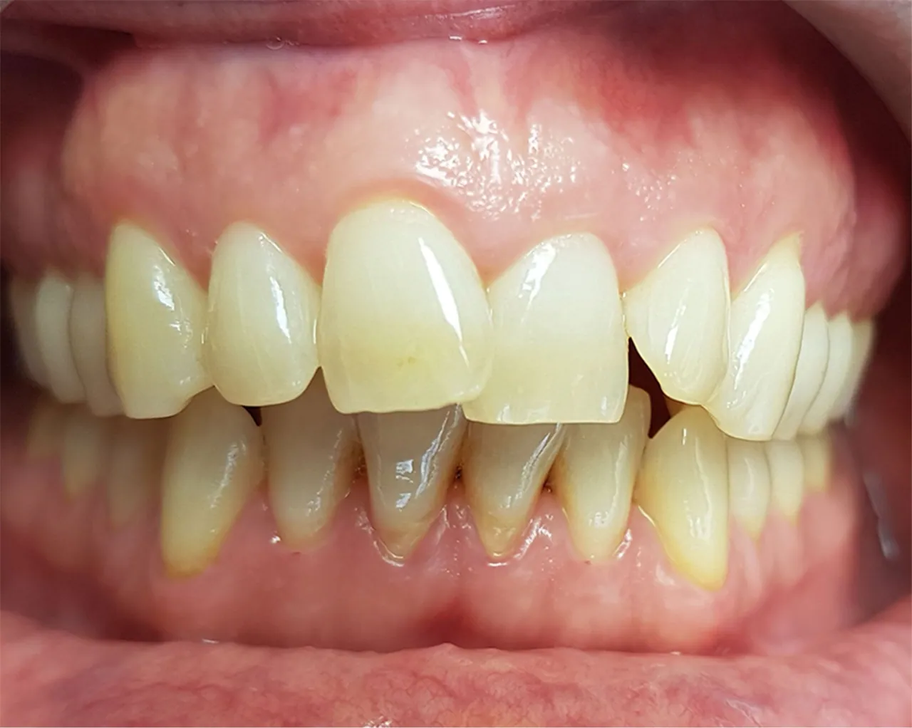 Case 01 — Before
