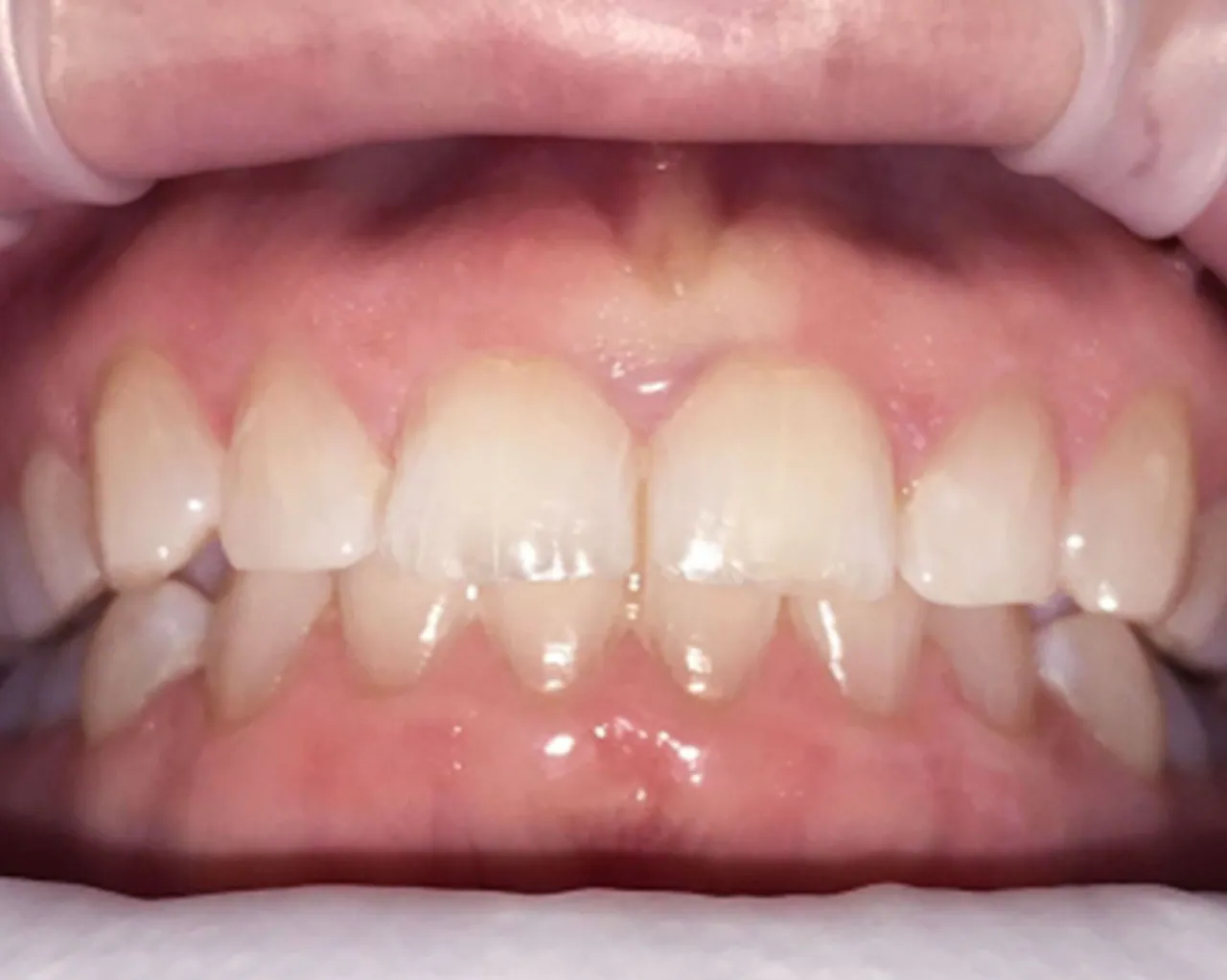 Case 02 — After