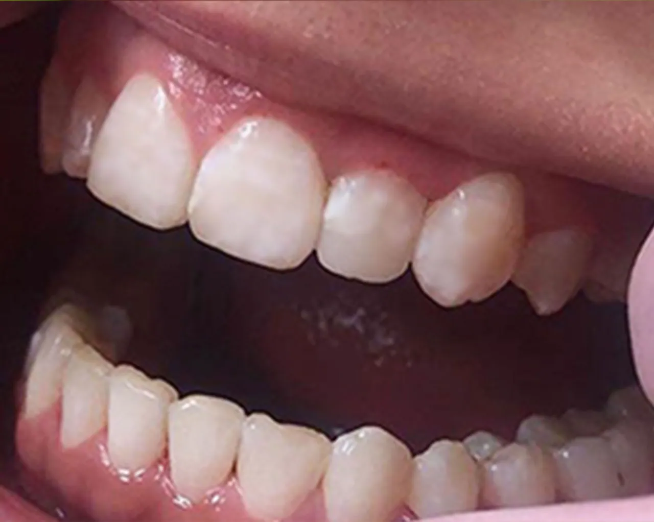 Case 03 — After