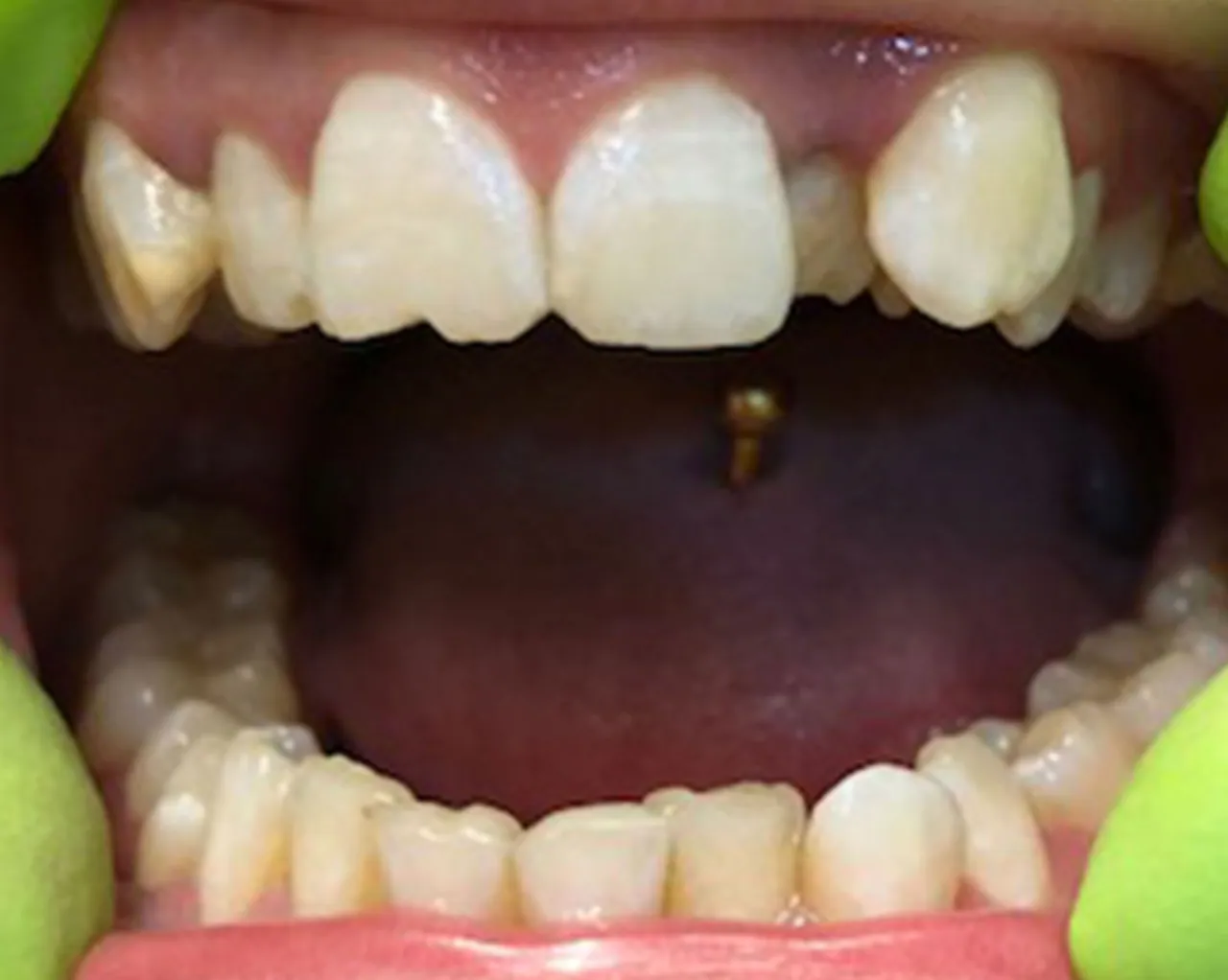 Case 03 — Before