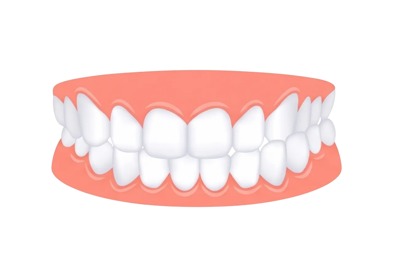 Crossbite