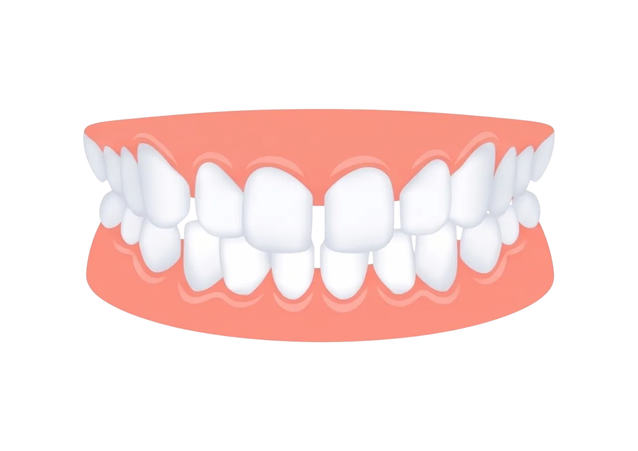 Gaps between teeth